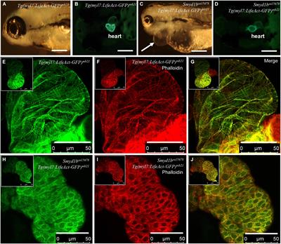 Overexpression of Lifeact-GFP Disrupts F-Actin Organization in Cardiomyocytes and Impairs Cardiac Function